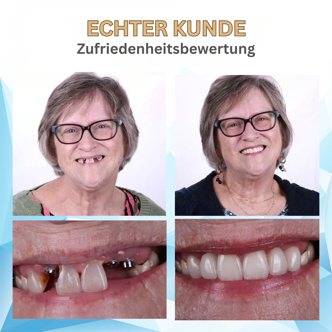 Bikenda | Genießen Sie den Komfort einer Zahnprothese zu einem Bruchteil des Preises