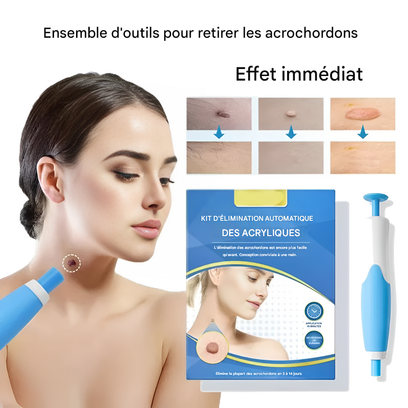 Entfernungskit für Hautanhängsel - Einfache Kryotherapie