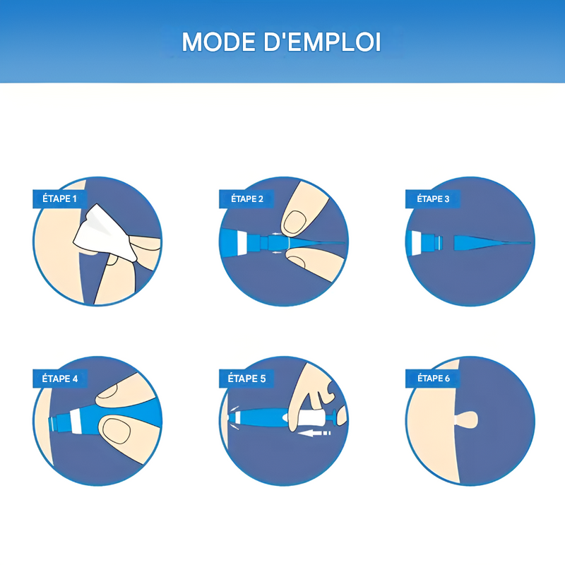 Entfernungskit für Hautanhängsel - Einfache Kryotherapie