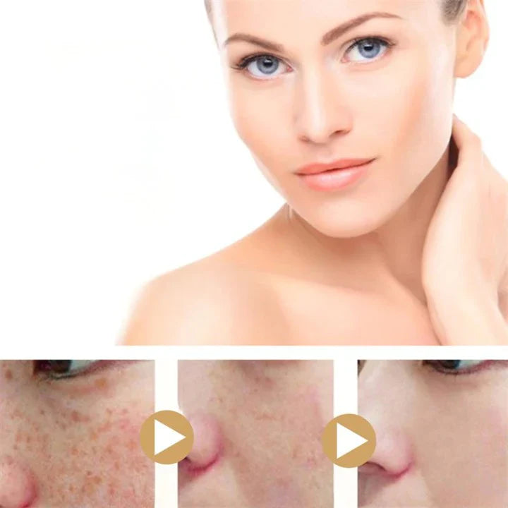 Kurkuma Dunkle Flecken Aufhellungsserum